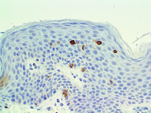 IHC of OX-40 on an FFPE Lymph Node Tissue